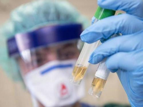 Немецкий Институт Роберта Коха: вакцину против коронавируса ждать до весны 2021