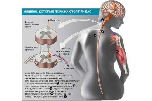 Как общался Стивен Хокинг. Как Стивен Хокинг разговаривал, когда болезнь лишила его этого навыка?