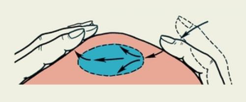 Флуктуация в различных сферах деятельности человека и в медицине