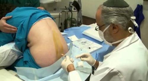 Флуктуация в различных сферах деятельности человека и в медицине