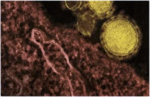 Защита от коронавируса. Какие лекарства нужно иметь дома для защиты от коронавируса 04 Защита от коронавируса. Какие лекарства нужно иметь дома для защиты от коронавируса 04