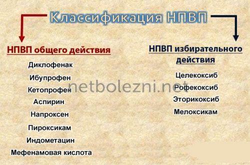 Обезболивающие при головной боли. Диагностика сосудистых типов головной боли 13