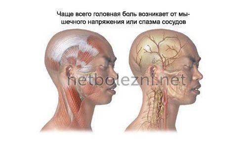 Обезболивающие при головной боли. Диагностика сосудистых типов головной боли 10