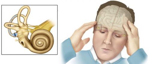 Головокружение при высоком давление. Анатомическая справка 02