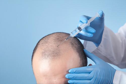 Как восстановить волосы после алкоголя. Как исправить пагубное влияние алкоголя на волосы