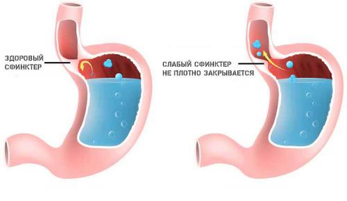Может ли постоянный кашель быть связан с проблемами желудочно-кишечного тракта. Неинфекционные причины развития патологического рефлекторного процесса