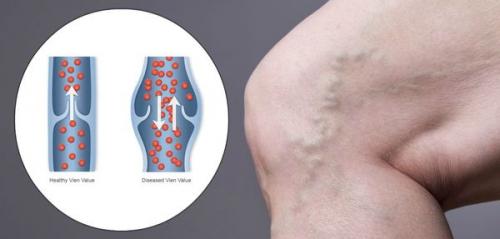 10 главных упражнений для тех. Топ-10 упражнений для глаз 09 10 главных упражнений для тех. Топ-10 упражнений для глаз 09