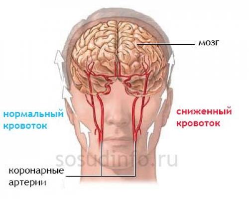 10 главных упражнений для тех. Топ-10 упражнений для глаз 01 10 главных упражнений для тех. Топ-10 упражнений для глаз 01