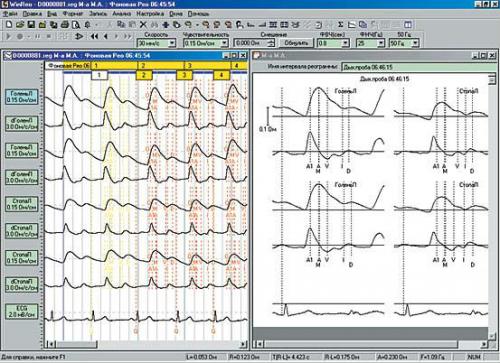 РЭГ головы, что показывает. РЭГ (реоэнцефалография) сосудов головного мозга