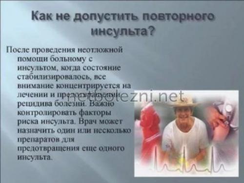 Не пропустите первые признаки инсульта. Симптомы, признаки инсульта 02