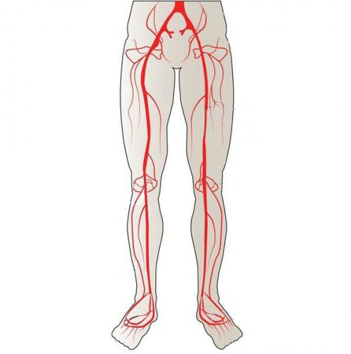 Лечение атеросклероза ног с ишемическими болями: современные методы 01