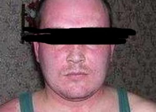 Аллергия на алкоголь красные пятна. Как проявляется аллергия на алкоголь