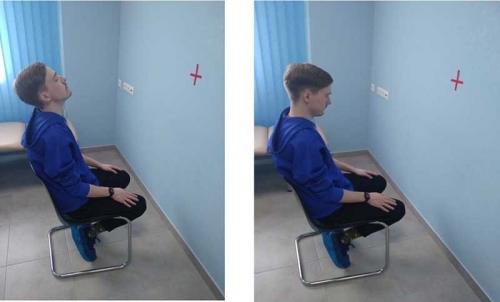 Вестибулярная гимнастика при дппг. Вестибулярная гимнастика