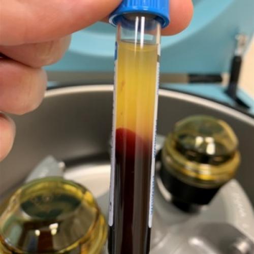 Борьба с коронавирусом: как выбрать подходящий респиратор 03 Борьба с коронавирусом: как выбрать подходящий респиратор 03