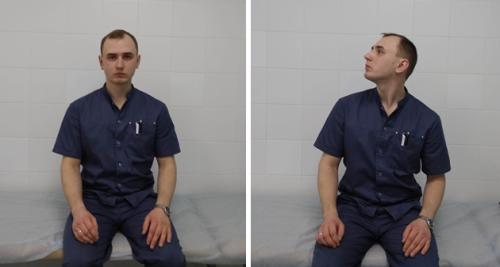 Самая эффективная вестибулярная гимнастика. Упражнения при доброкачественном пароксизмальном позиционном головокружении