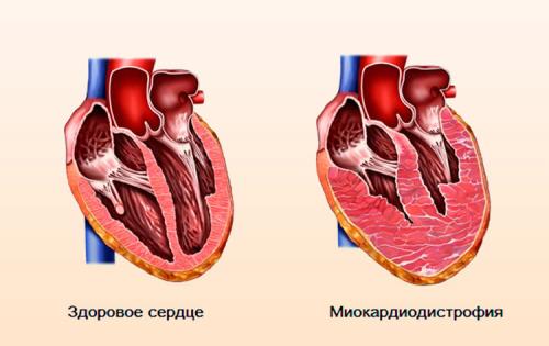 Таблетки от высокого давления быстрого действия под язык. Показания и особенности «Каптоприла»