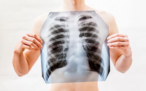 Физическая зависимость от алкоголя. Признаки физической зависимости от алкоголя