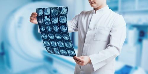 Разбор основных механизмов развития дисциркуляторной энцефалопатии 01