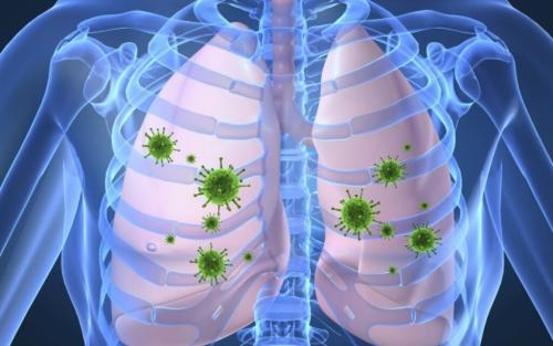 Могут ли люди с определёнными заболеваниями или состояниями иметь больший риск развития тяжёлой степени COVID-19. Люди с какими сопутствующими заболеваниями чаще умирают от COVID-19?