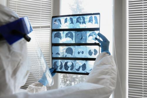 Какие факторы влияют на вероятность повторной инфекции короновирусом. Можно ли заболеть коронавирусом, если есть антитела