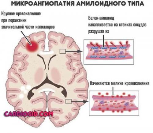 Как Понять, что Сосуды Головы Не в Порядке. Вопрос-ответ: 06 Как Понять, что Сосуды Головы Не в Порядке. Вопрос-ответ: 06