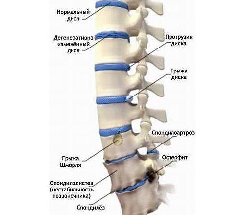 Простые упражнения йоги для растяжки и укрепления позвоночника. Позы йоги для спины и шеи 09