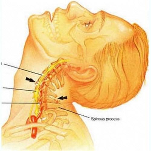 Если болит спина и шея. Причины болей в спине 04