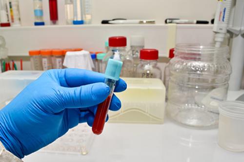 Влияние алкоголя на печень. Методы лечения