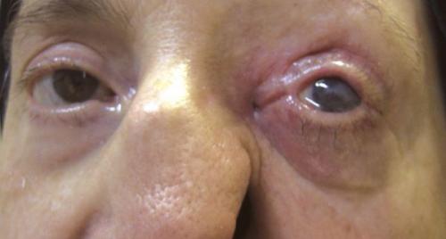 Тройничный нерв: лечение и возможности 01