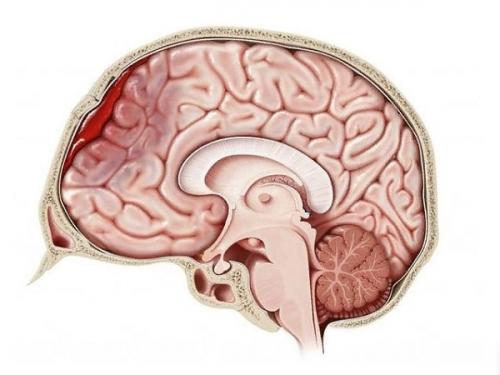 Упала на спину и ударилась головой. После удара головой или после падения