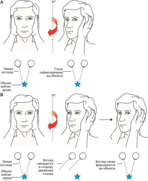 Психогенное головокружение симптомы и лечение