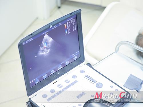 Стенокардия и инфаркт миокарда. Классификация ишемической болезни сердца 01