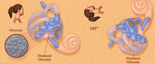 Внутреннее ухо: как отличить сотрясение от других проблем 02 Внутреннее ухо: как отличить сотрясение от других проблем 02
