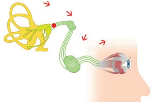 Внутреннее ухо: как отличить сотрясение от других проблем 01 Внутреннее ухо: как отличить сотрясение от других проблем 01