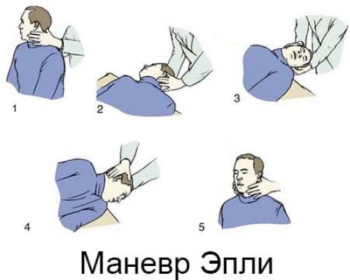 Как устранить головокружение при вставании. Симптомы системного головокружения 01