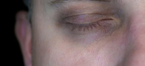 Признаки алкоголизма у мужчин. Почему развивается алкоголизм