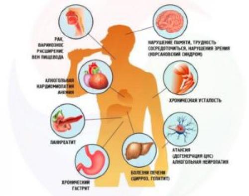 Систематическое употребление алкоголя это. Формы злоупотребления алкоголем: бессистемная форма