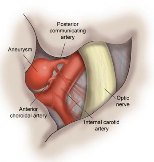 Лицевая невралгия vs. неврит: основные отличия и симптомы 05 Лицевая невралгия vs. неврит: основные отличия и симптомы 05