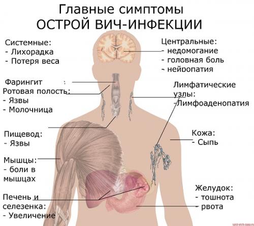 Частые простуды при вич. Острая инфекция