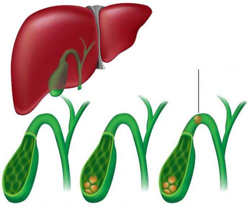 Как быстро очистить организм после запоя: эффективные методы восстановления 04