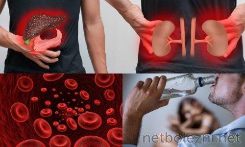 Эффективные препараты для борьбы с коронавирусом: что нужно знать 02 Эффективные препараты для борьбы с коронавирусом: что нужно знать 02