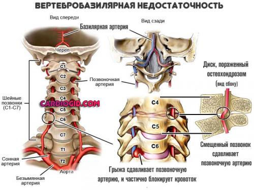 Может ли правильное питание и образ жизни помочь предотвратить сосудистые нарушения, вызывающие шум в ухе. Шум в голове и ушах: причины, как от него избавиться медикаментами, а когда нужна операция