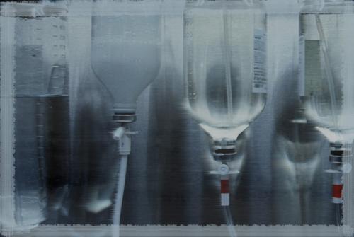 Варианты алкогольного абстинентного синдрома. Отличия между обычным похмельем и абстинентным синдромом 04 Варианты алкогольного абстинентного синдрома. Отличия между обычным похмельем и абстинентным синдромом 04