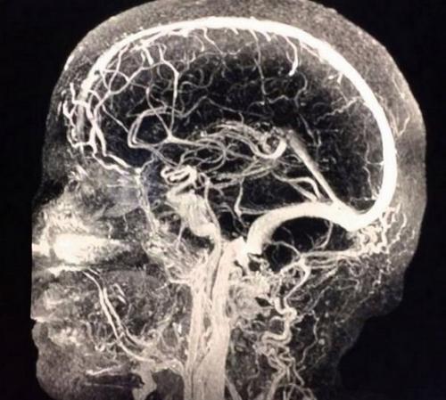 Современные методики применения МРТ в диагностике нарушений мозгового кровообращения 02 Современные методики применения МРТ в диагностике нарушений мозгового кровообращения 02