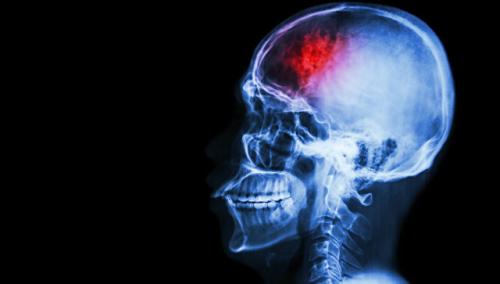 Современные методики применения МРТ в диагностике нарушений мозгового кровообращения 01 Современные методики применения МРТ в диагностике нарушений мозгового кровообращения 01