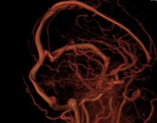 Современные методики применения МРТ в диагностике нарушений мозгового кровообращения 05 Современные методики применения МРТ в диагностике нарушений мозгового кровообращения 05