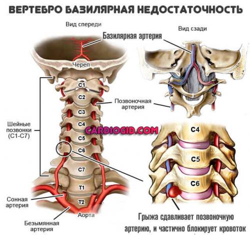 Какие основные типы нарушений мозгового кровообращения существуют. Нарушение кровообращения головного мозга: симптомы и признаки в зависимости от типа, причины и лечение
