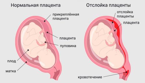 Боли внизу живота при беременности: что важно знать в каждом триместре 01 Боли внизу живота при беременности: что важно знать в каждом триместре 01