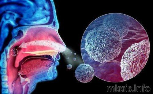Какие симптомы коронавируса проявляются на первый день инфекции у взрослых 01 Какие симптомы коронавируса проявляются на первый день инфекции у взрослых 01