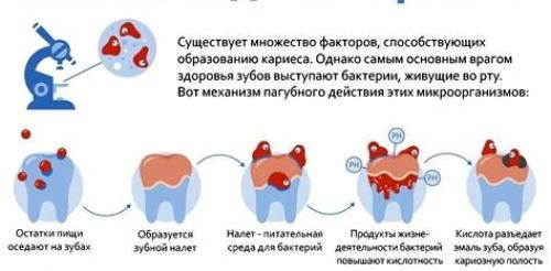 Стоит ли обращать внимание на ухудшение общего самочувствия на седьмой-восьмой день заболевания. Почему нужно лечить кариес